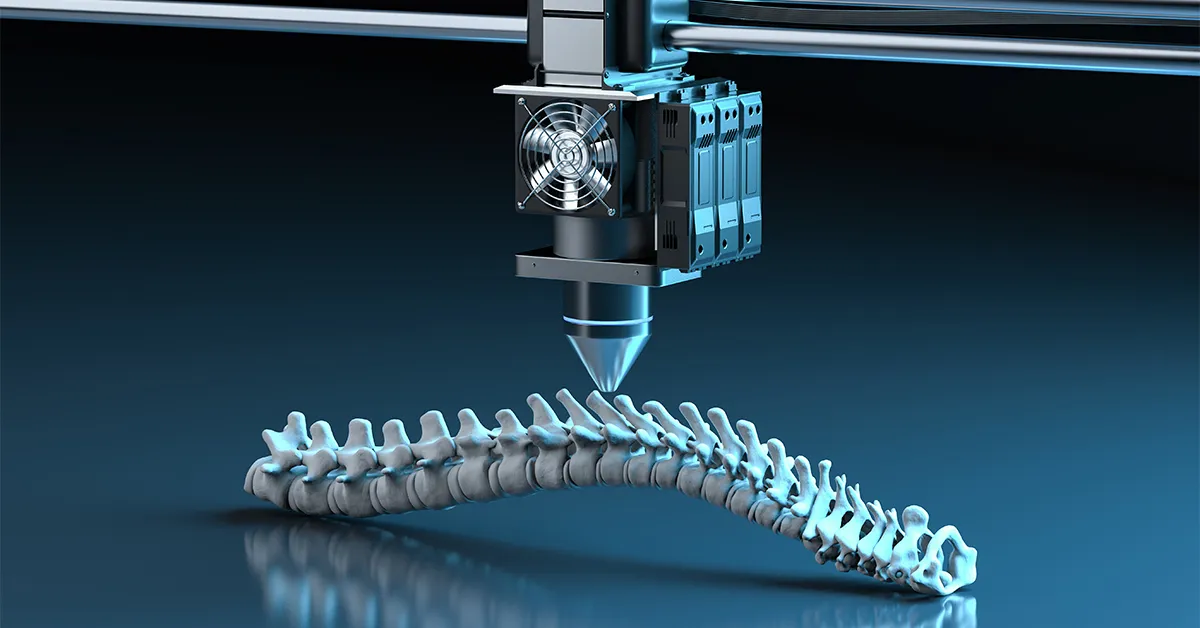 um-osso-impresso-em-3d